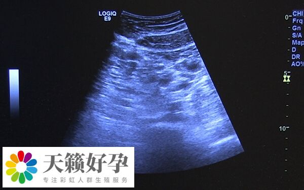 卵泡大于18打夜針最好