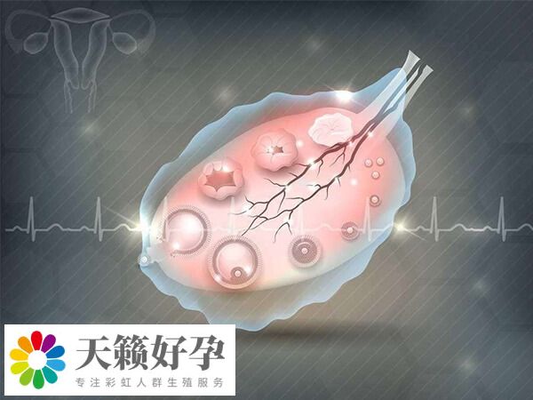 取卵后腹痛可能是卵巢刺激