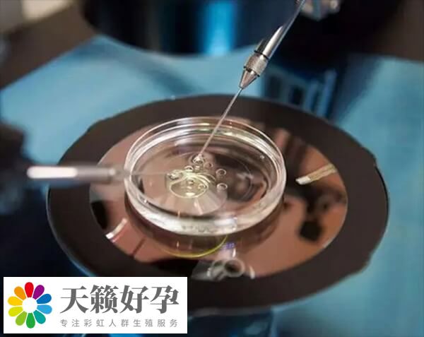 俄羅斯有三代試管胚胎全染色體篩查