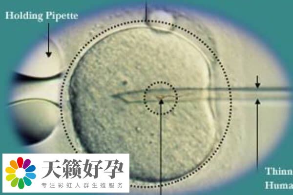 融合胚胎是一種胚胎發(fā)育的階段